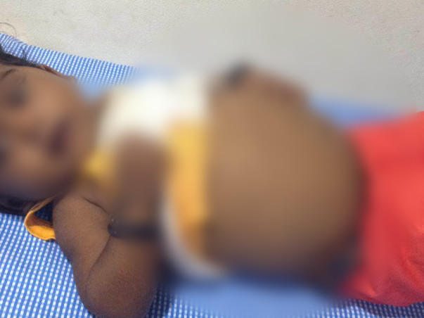 Help this 7-month-old undergo a liver transplant