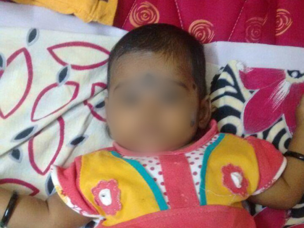 Help Baby Ridhi Undergo A Liver Transplant