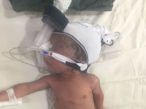 Help Baby Of Neha Recover From Ecoli Septicemia