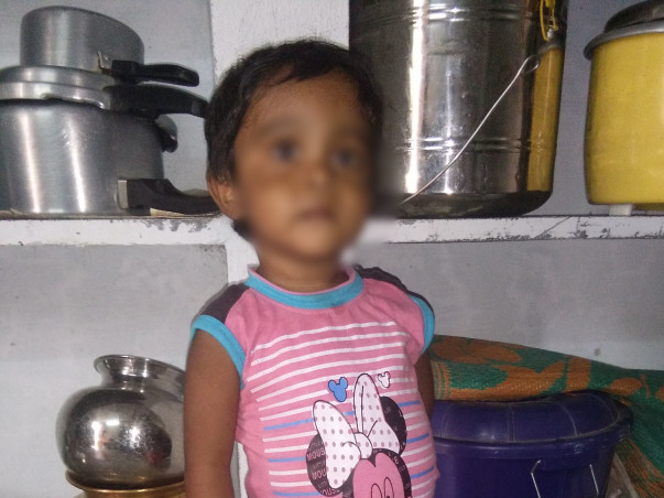 Help Little Sanjay Undergo A Liver Transplant