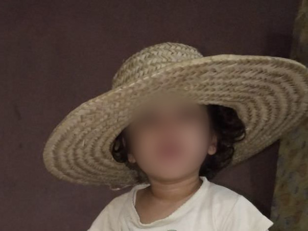 Help Baby Saanvi raise funds to get stem cell transplantation