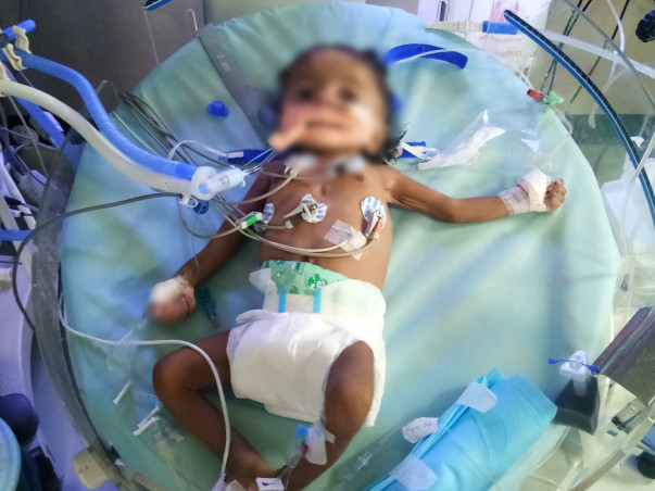 Nellore School Teacher Struggles To Save 5-Month-Old Daughter’s Life