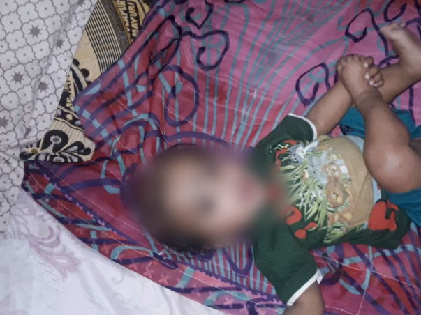 8-Month-Old Thanvik May Die Of Infections Without Your Help