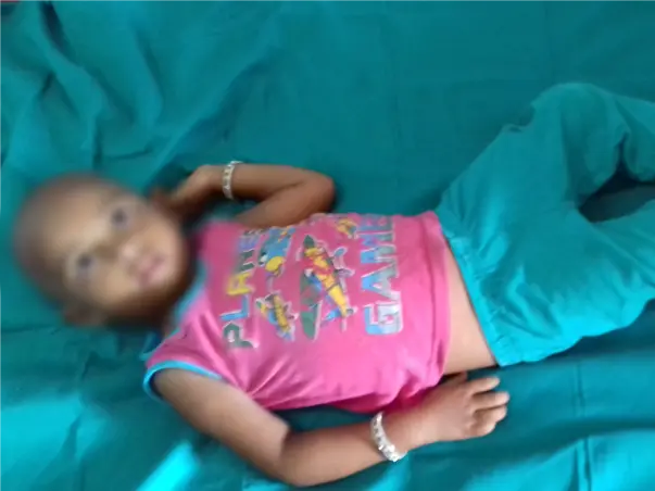 3-year-old Rithu needs your help to undergo a liver transplant