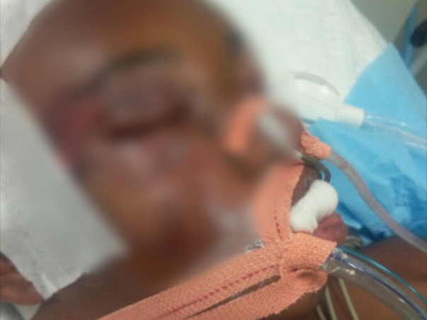 Help Rakesh fight with Brain Injury