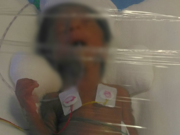 Fund something to save my baby