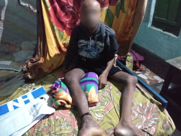 Help 14-year-old Boy Whose Parents Don't Understand He Has Bone Cancer