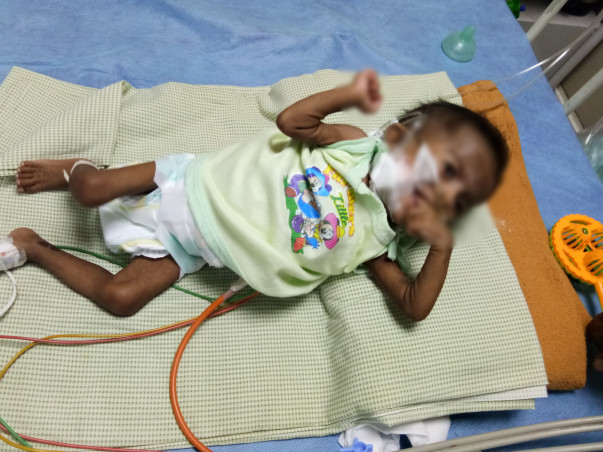 Help 8-month-old baby girl fight a severe lung condition