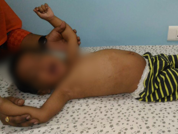Baby Riyansh Has Not Known Life Without Pain And Suffering
