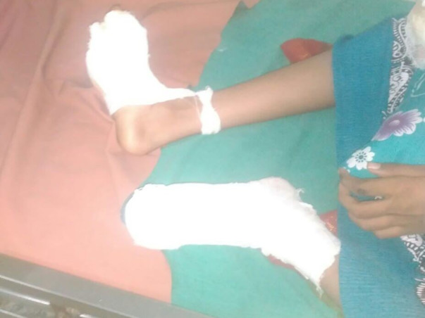 Help Helen (Her hands got amputated in a Electric shock)