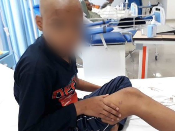 This 10-Year-Old School Topper Will Lose His Leg & Life To Bone Cancer