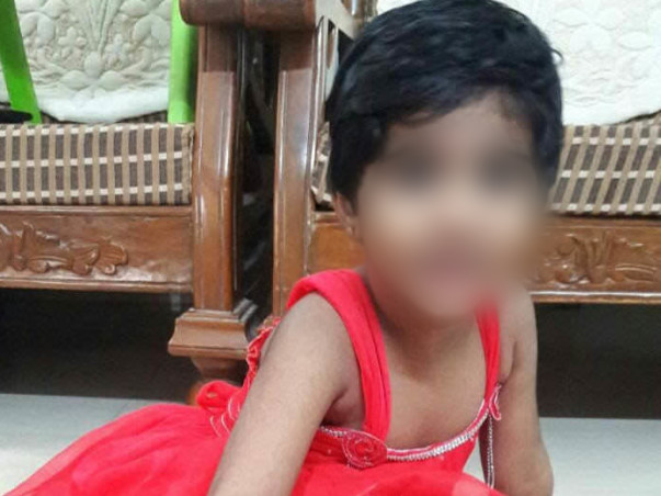 You Can Save 3-year-old Sandhiya Who Is On Artificial Lung Machine