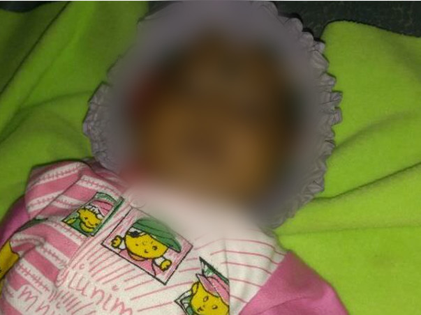 Help Jashwanth fight against obstruction of cardiac TAPVC