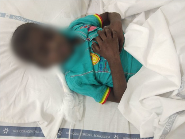 Help Rukmandar Whose Body Has Stopped Producing Blood