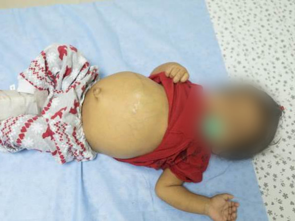 At the age of 9-months baby Pranavi has a serious liver disease
