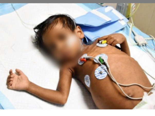 Please donate as much as you can to save my sis kid by Prakash