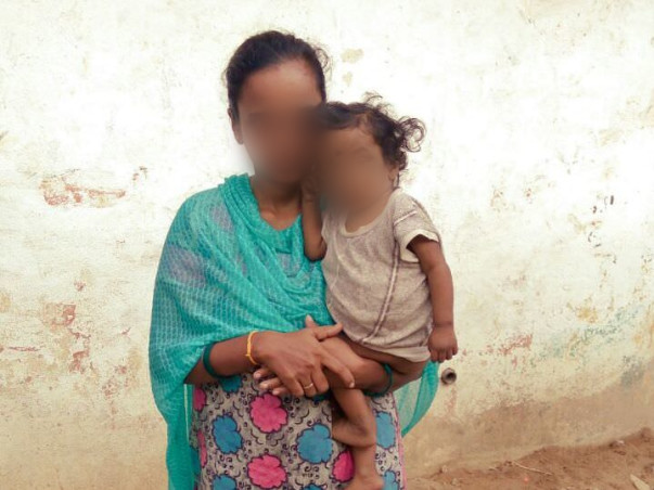 Please Help 1 Year Old Devansh Fight Biliary Atresia