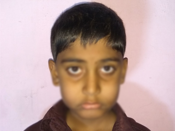 This Mother Fights Alone To Save Son From Cancer For The Second Time