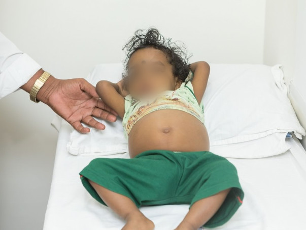 Please Help 1 Year Old Devansh Fight Biliary Atresia