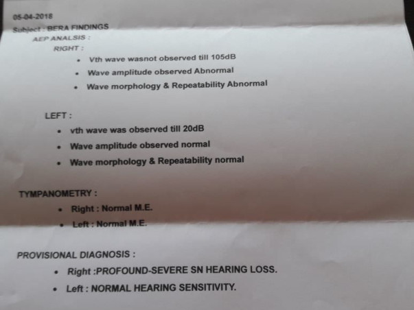 Help 1.5 Year Old Rohit Manikanta Hear The World.