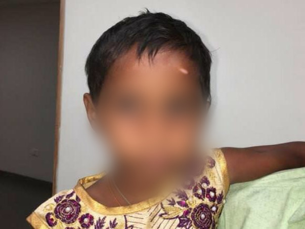 Help Deepa Who Requires A Jaw Surgery To Open Her Mouth