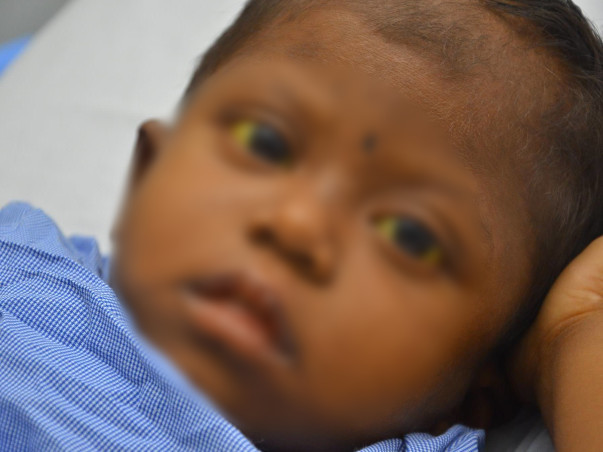 Help 4-Year-Old Who Scratches Skin and Pulls Hair Out In Pain