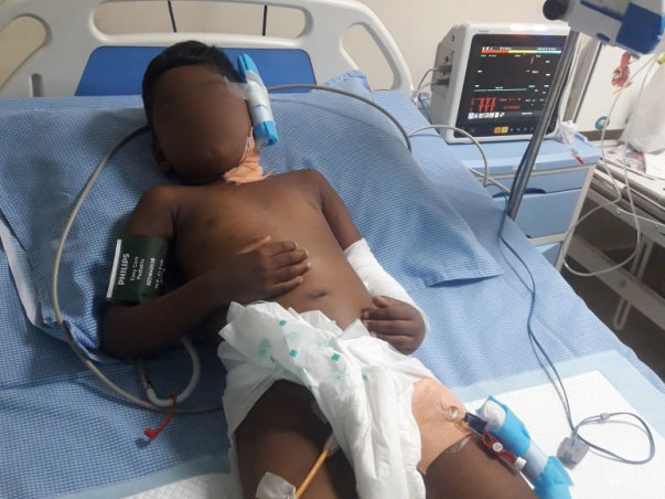 Urgent: 6-year-old Akhil Is In Severe Pain From Kidney Failure