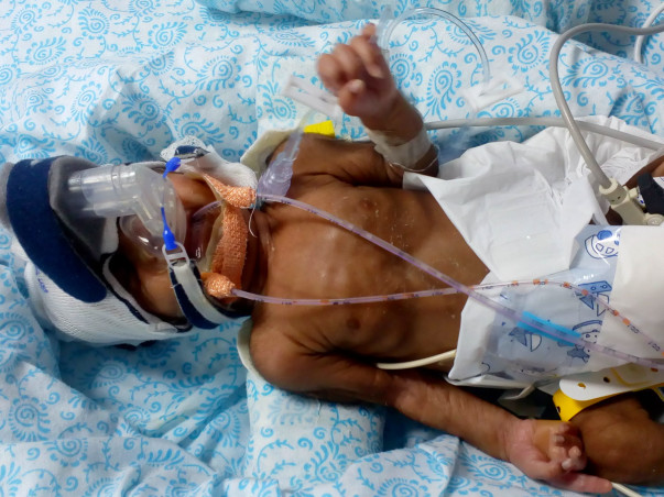 Support For Baby Of Chitra