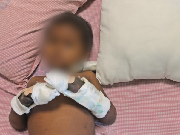 Gokul Has A Flesh-Eating Infection That Has Put His Life In Danger