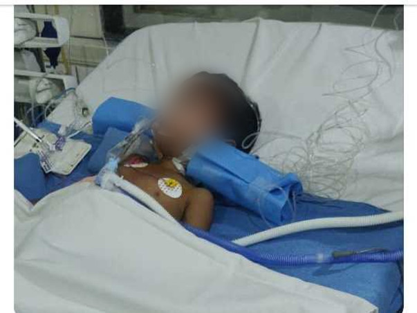 Support 6 Year Old Nadeem who met with a Tractor Accident