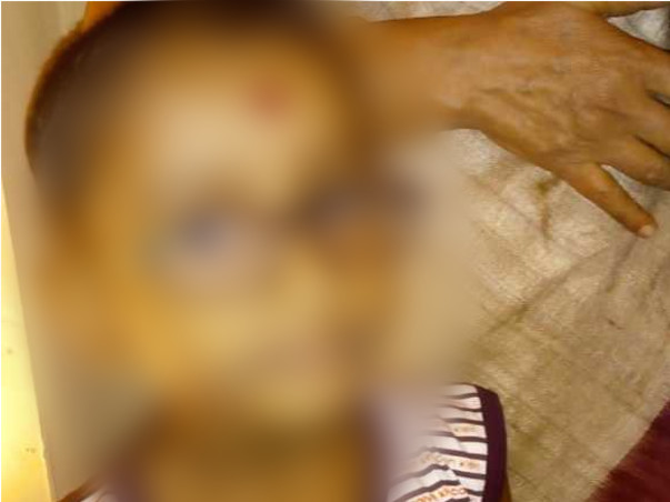 Help Saptangshu fight Ulcerative Colitis