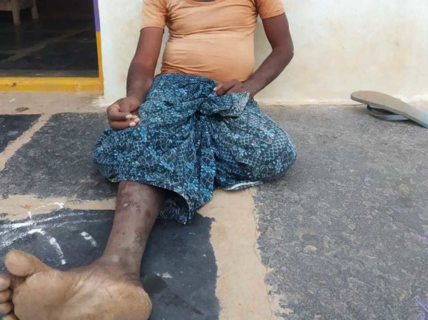 Help Kuruba Eshwarappa Get Treated for Paralytic Stroke