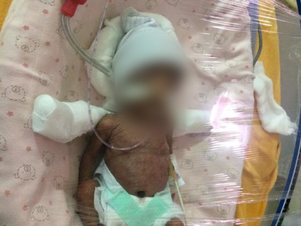 HELP B/O Anasuya , a Baby girl in NICU recover