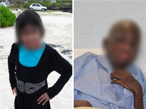 This 13-year-old Has No Friends Or A Childhood Because Of Lupus