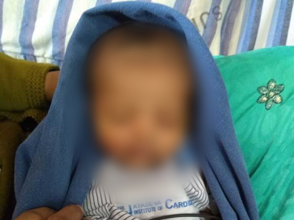 Help 4 Month Old Shravya Get Treated for 3 Holes in her Heart