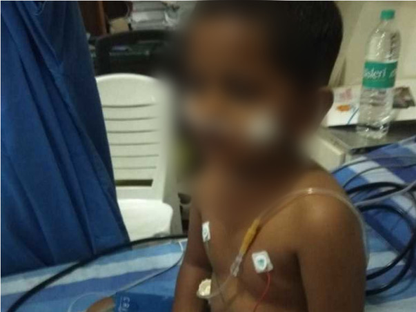 Help 3-year-old Asad Get Treated