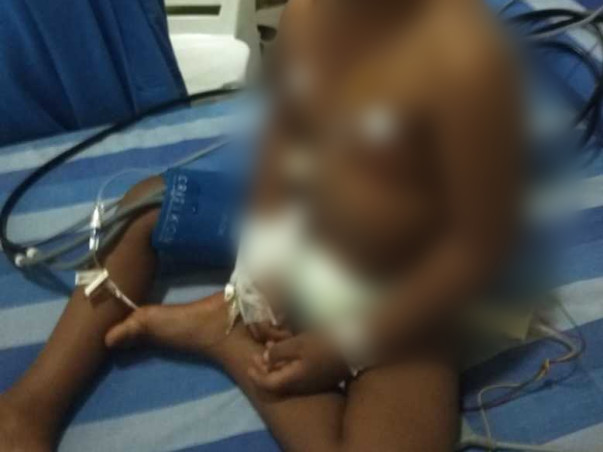 Help 3-year-old Asad Get Treated