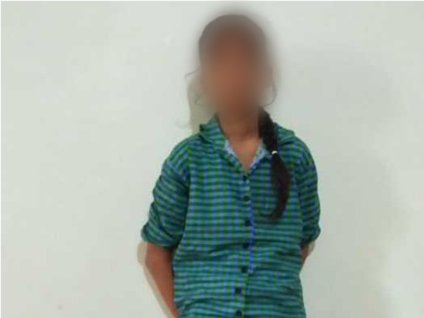 Help 10-yr-old girl Hawrah Recover From Tongue Disorder