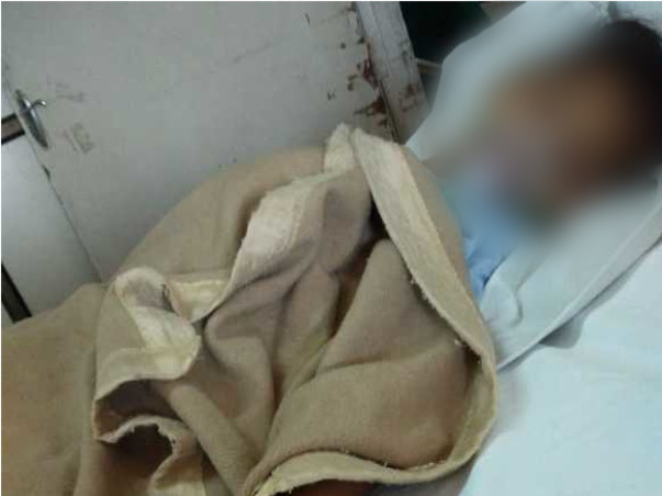 Help 10-yr-old girl Hawrah Recover From Tongue Disorder