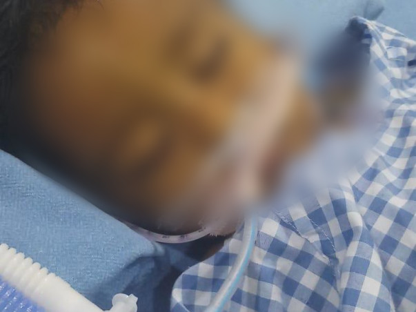 Help Baby John Recover From A Serious Liver Disease