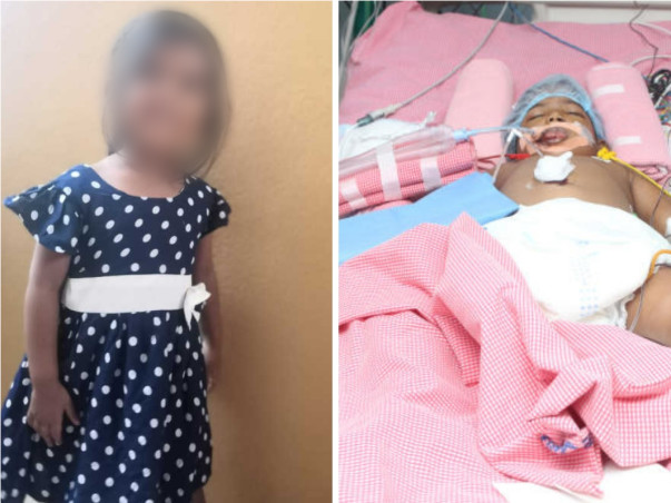 Eshitha needs your help to undergo her treatment