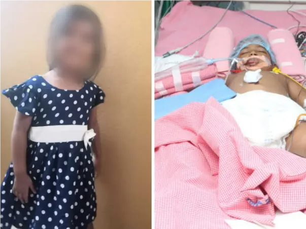 Eshitha needs your help to undergo her treatment
