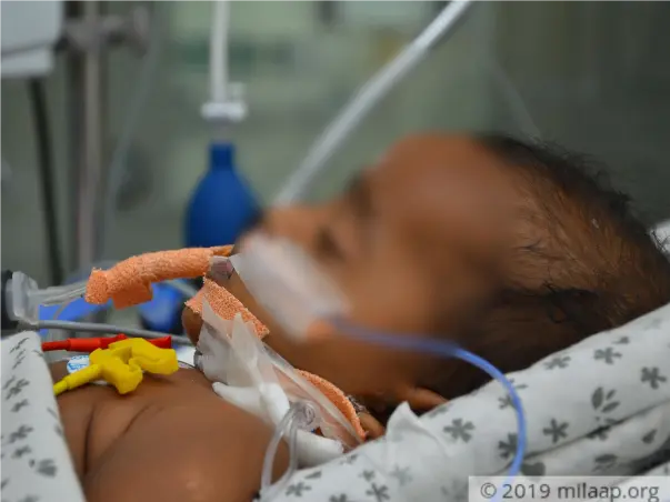 Help 5-month-old Who Had Seizures And Is The ICU With Brain Fever