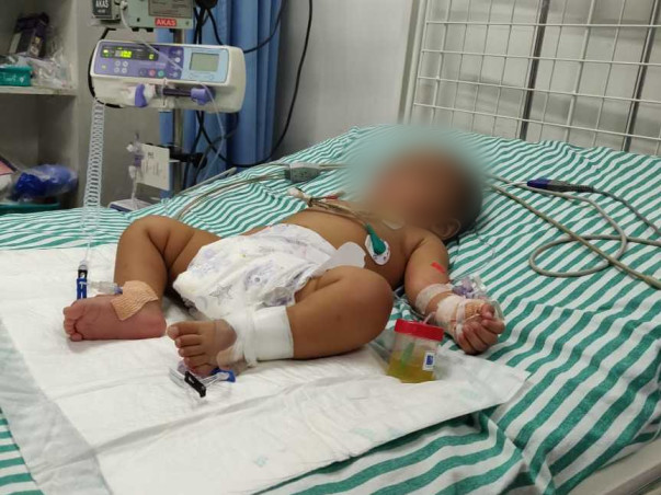 Help 5 months baby Sharvesh having septic spreads acroos body