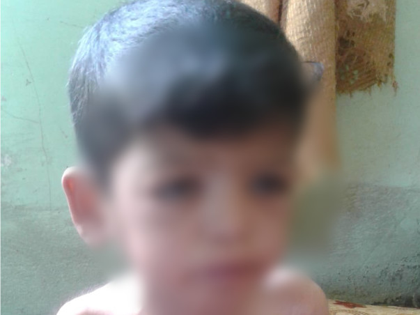 Help War Torn Baby Yunus Undergo A Life Saving Heart Surgery