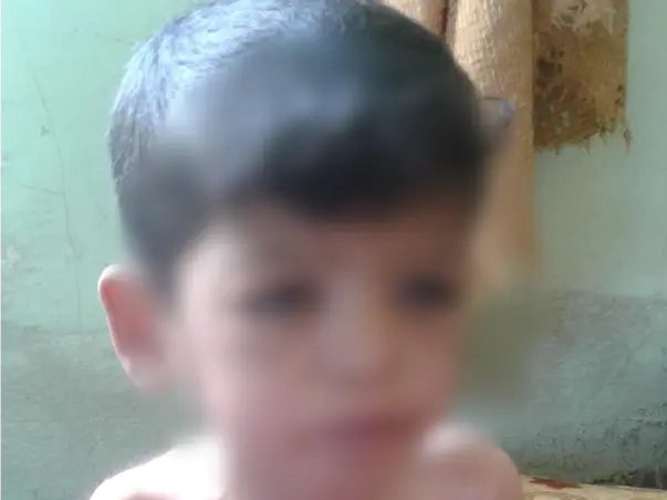 Help War Torn Baby Yunus Undergo A Life Saving Heart Surgery