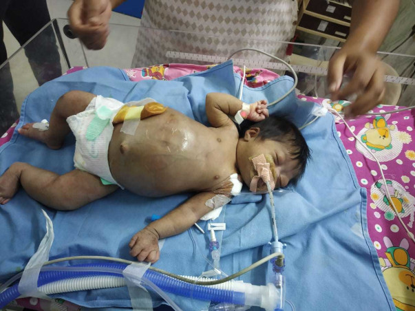 My daughter is fighting for her life from day one