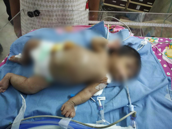 My daughter is fighting for her life from day one