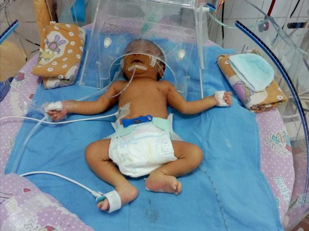 Help Our Baby Girl's Treatment for Brain Infection