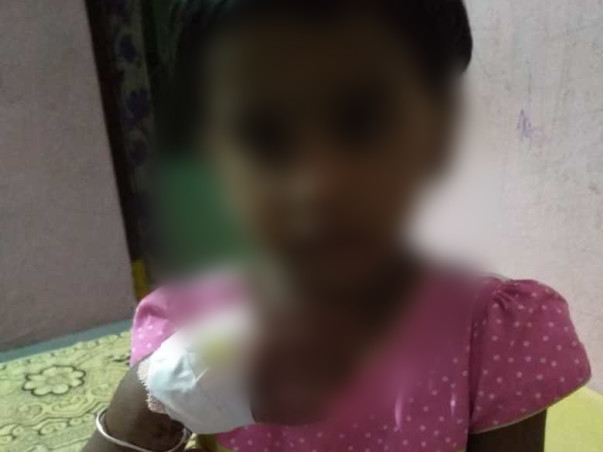 Help my Daughter  Srikruthi survive MOG Neurology disease